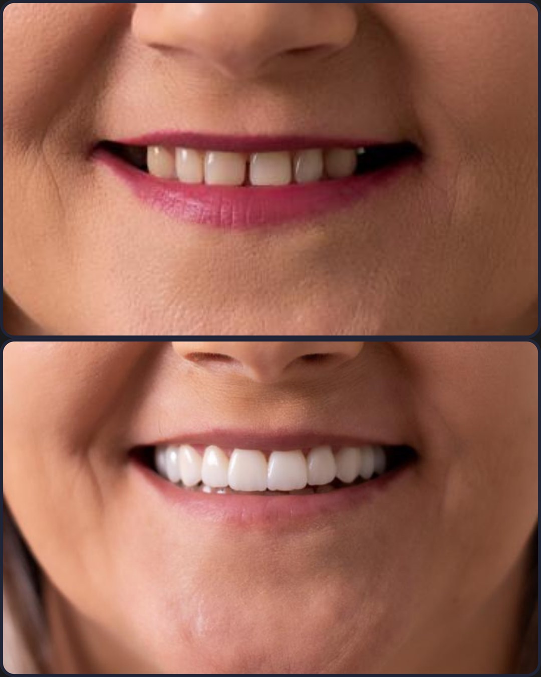 Antes e depois - OdontoSin