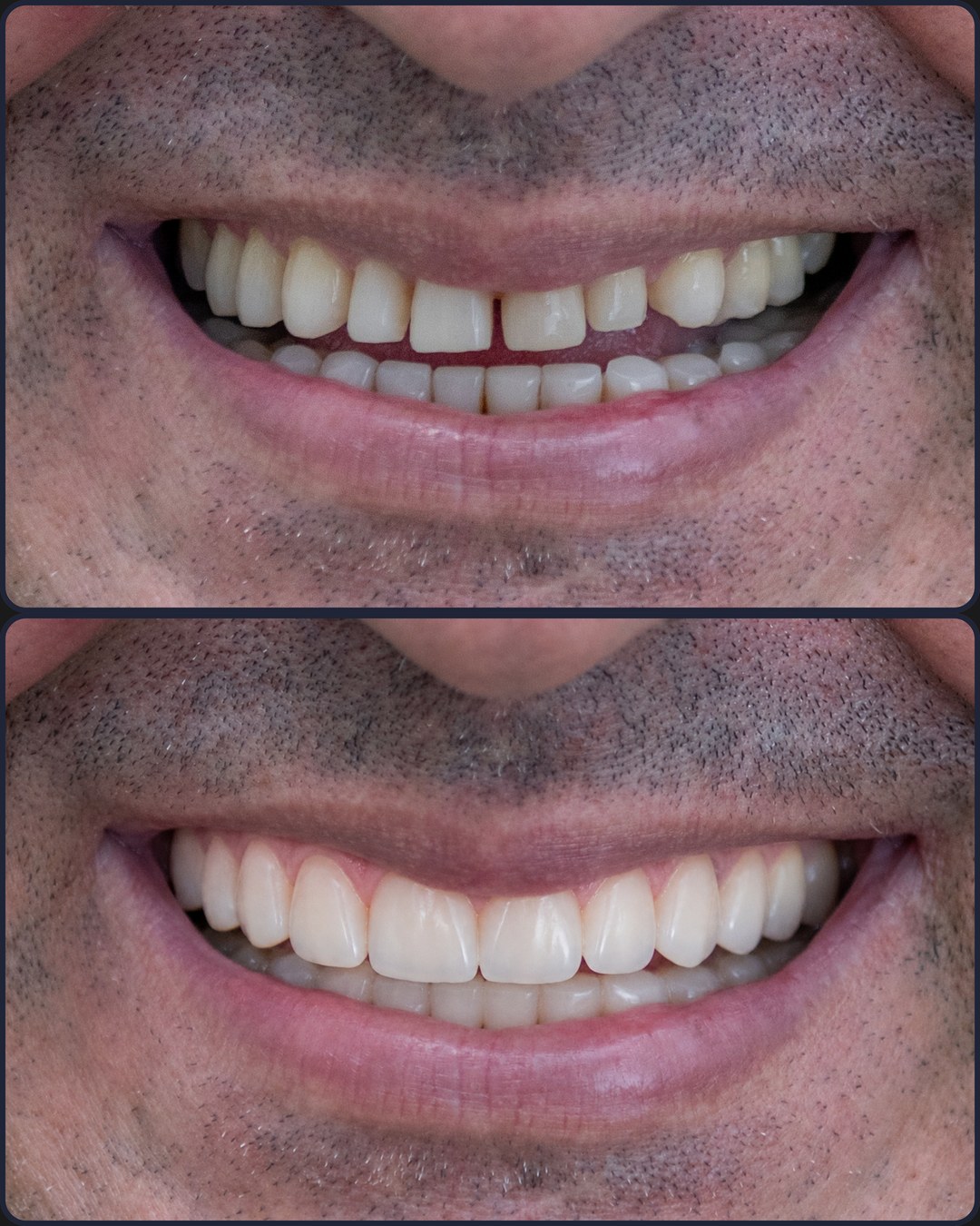 Antes e depois - OdontoSin